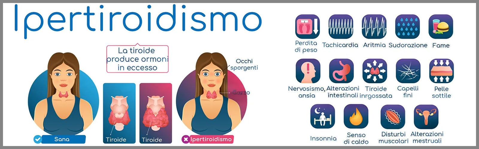 Visita endocrinologica per Ipertiroidismo con Ecografia Tiroide