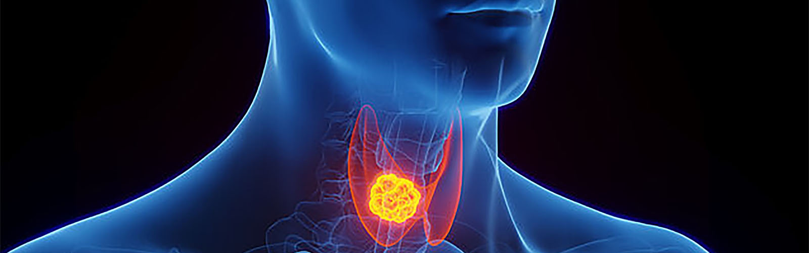Visita endocrinologica per Tumore alla Tiroide con Ecografia